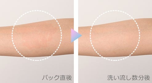 肌に赤みが出る理由