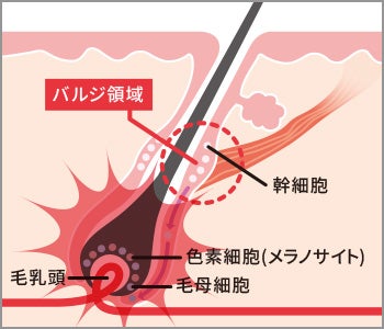 従来の方法(IPL方式)