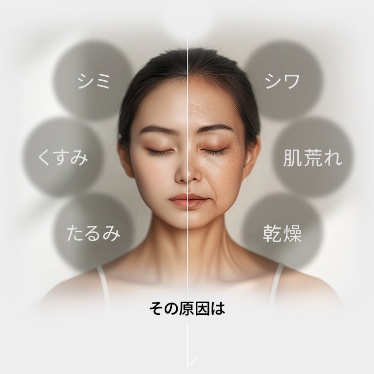 シミ・くすみ・たるみ・シワ・肌荒れ・乾燥…その原因は