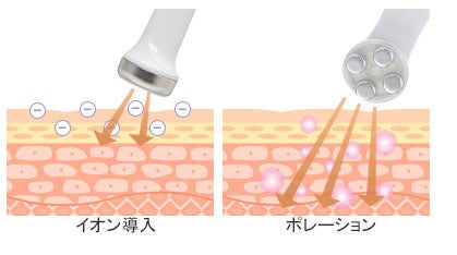 イオン導入とポレーションの違い