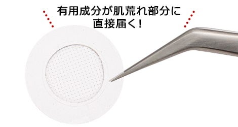 ポツッとできた肌荒れに貼る部分用ケアパッチ