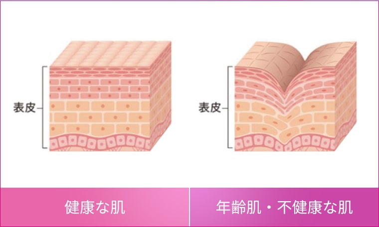 健康な肌と年齢肌・不健康な肌の角質層