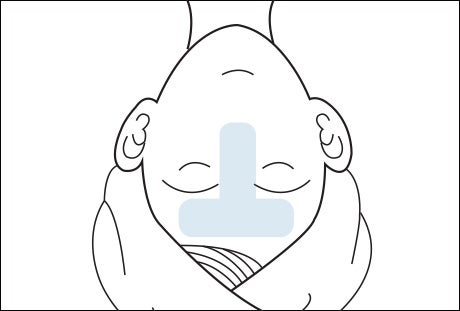 吸引施術方法イメージ図1