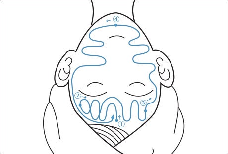 イオン導入施術方法イメージ図