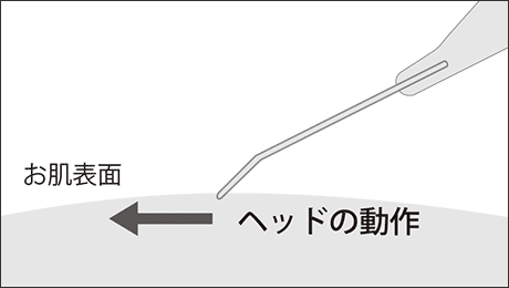 洗浄施術方法イメージ図1