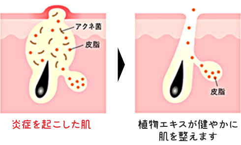 植物エキスが健やかに肌を整えます