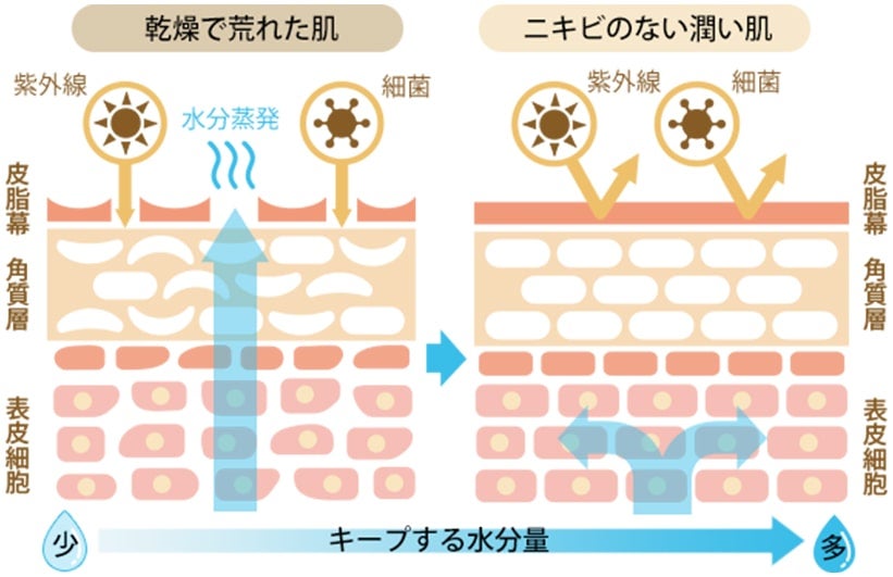肌の乾燥はニキビの大敵