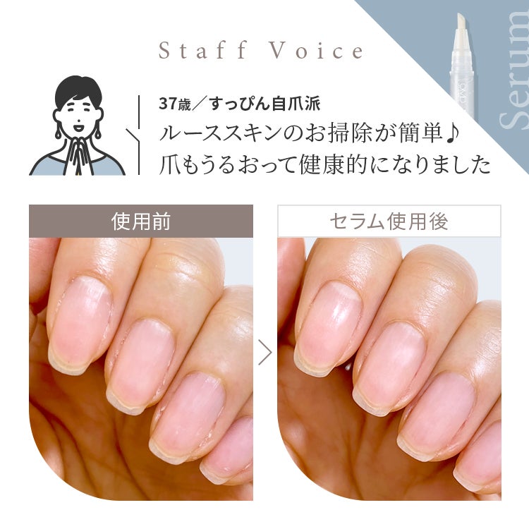 Staff Voice「ルーススキンのお掃除が簡単♪爪もうるおって健康的になりました」