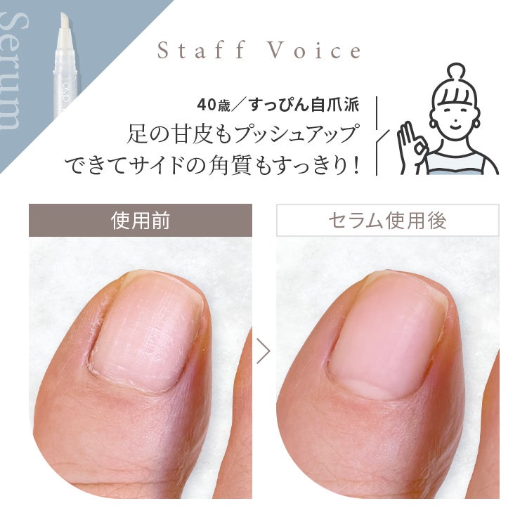 Staff Voice「足の甘皮もプッシュアップできてサイドの角質もすっきり！」