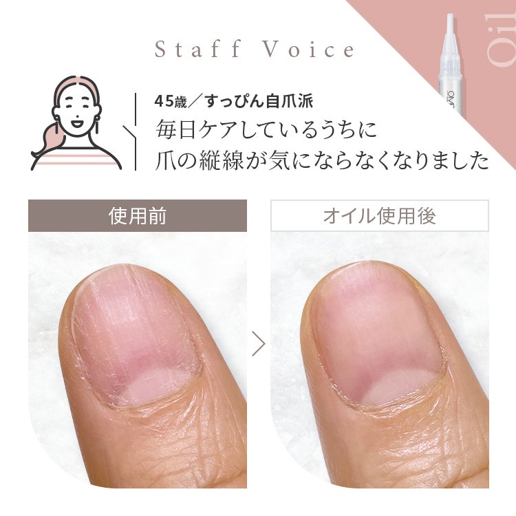 Staff Voice「毎日ケアしているうちに爪の縦線が気にならなくなりました」