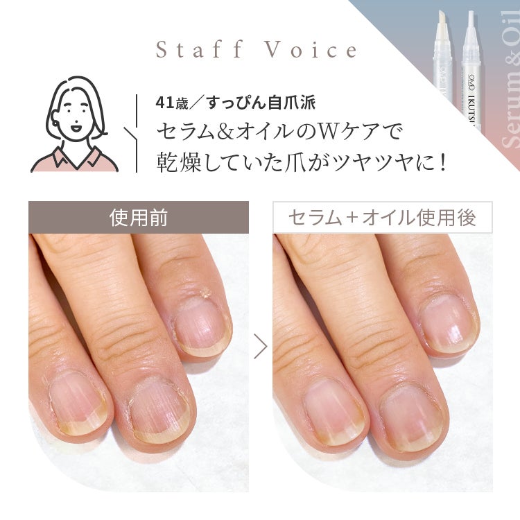 Staff Voice「セラム&オイルのWケアで乾燥していた爪がツヤツヤに！」