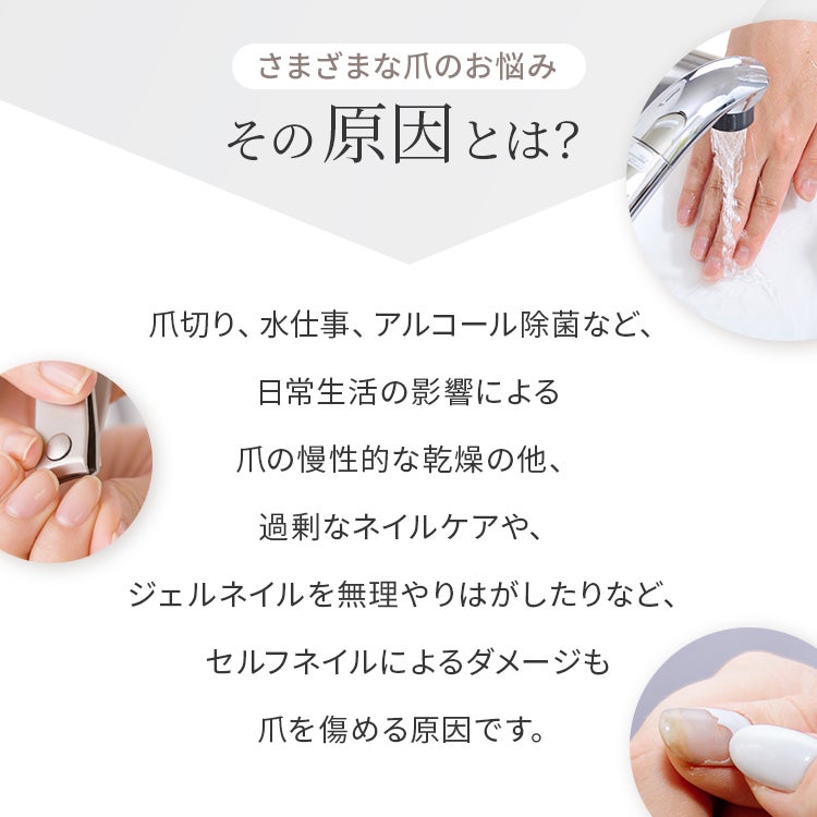 さまざまな爪のお悩み その原因とは？