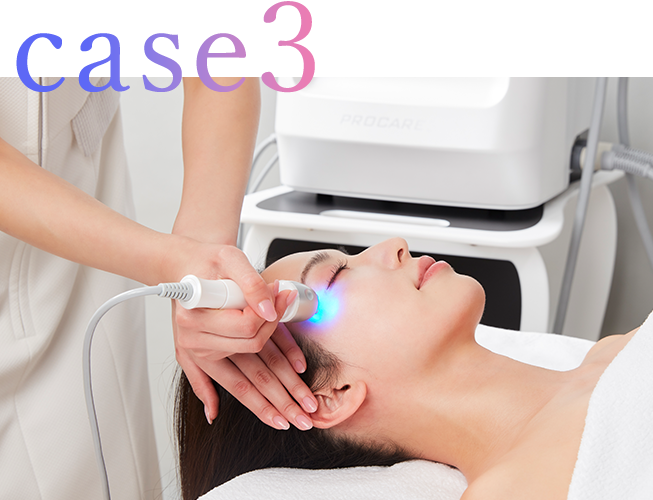 case3 フェイスタイトニングコース